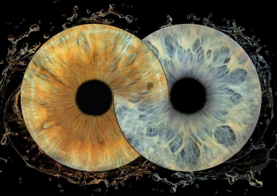 IRIS Photography (macro photo of your eye) - What you can expect in those 10 minutes